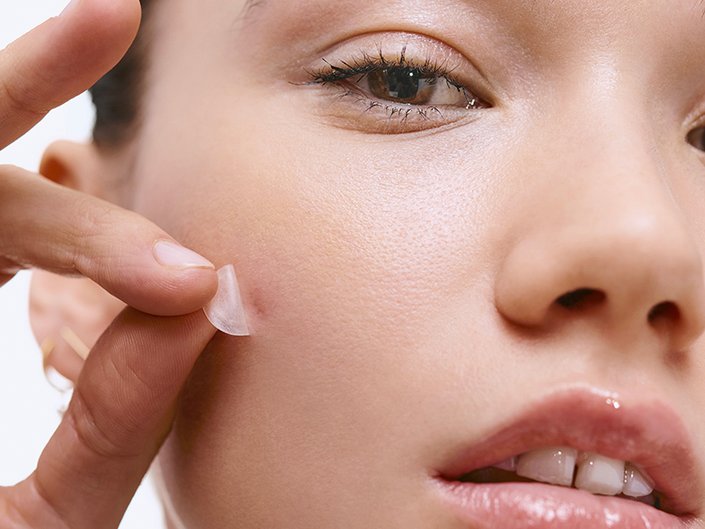 Acne and Pimple