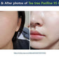 Dr. Ceuracle Tea tree Purifine 95 Essence 50ml