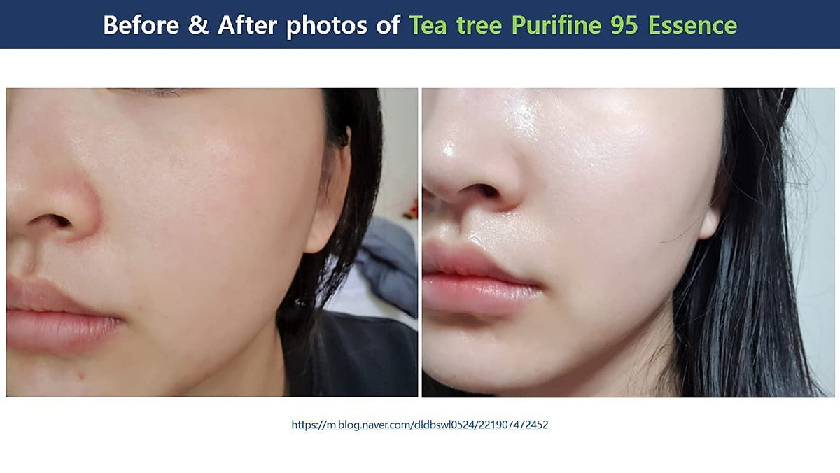 Dr. Ceuracle Tea tree Purifine 95 Essence 50ml