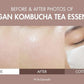 Dr. Ceuracle Vegan Kombucha Tea Essence