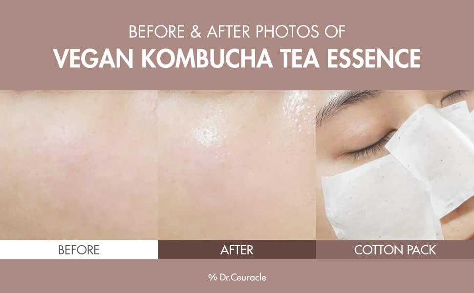 Dr. Ceuracle Vegan Kombucha Tea Essence