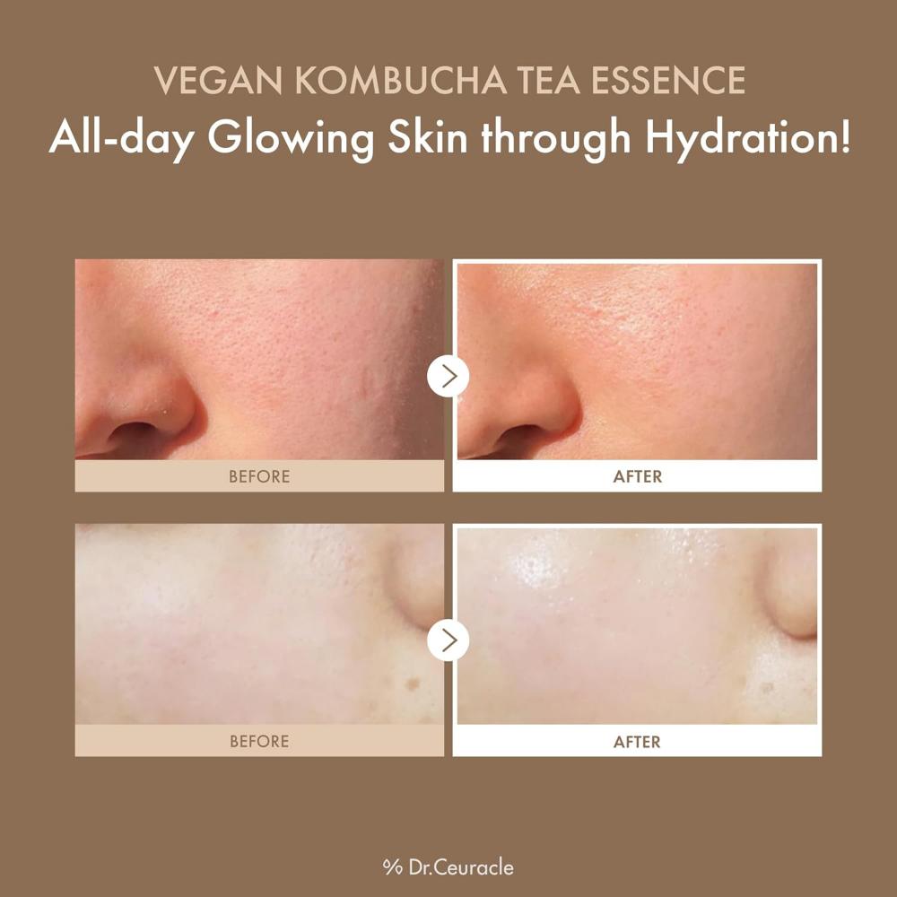 Dr. Ceuracle Vegan Kombucha Tea Essence